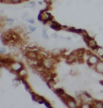 TULP4 Rabbit Polyclonal Antibody