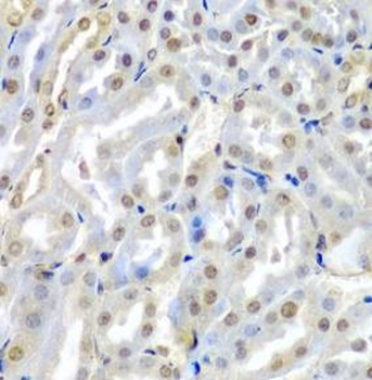 TUSC2 Rabbit Polyclonal Antibody
