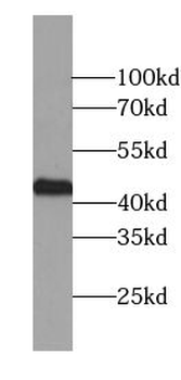 TWF1 Rabbit Polyclonal Antibody