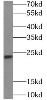 TWIST1 Antibody