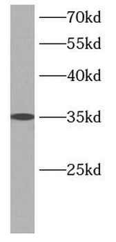 TWSG1 Rabbit Polyclonal Antibody