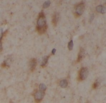 TWSG1 Rabbit Polyclonal Antibody