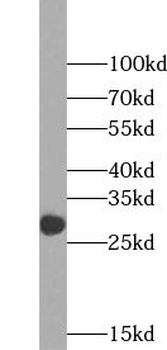 TXNDC11 Rabbit Polyclonal Antibody
