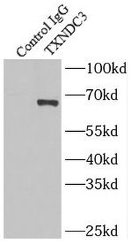 NME8 Rabbit Polyclonal Antibody