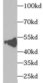 TXNDC5 Antibody