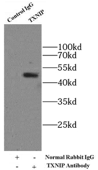 TXNIP Rabbit Polyclonal Antibody