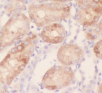 TXNIP Rabbit Polyclonal Antibody