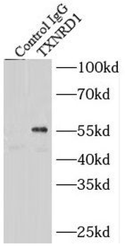 TXNRD1 Rabbit Polyclonal Antibody