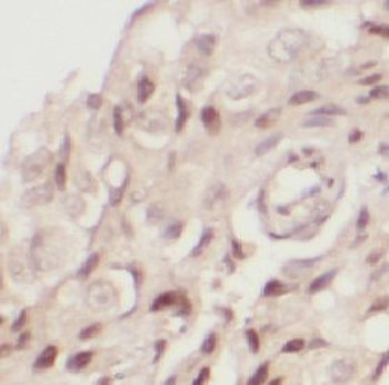 TXNRD1 Rabbit Polyclonal Antibody