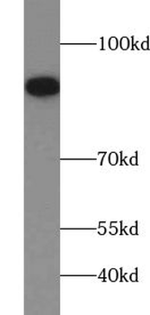 UBA2 Rabbit Polyclonal Antibody