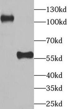 UBA6 Rabbit Polyclonal Antibody