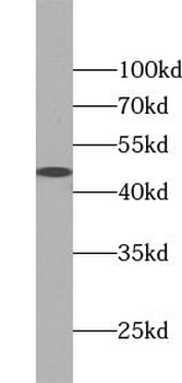 UBAC1 Rabbit Polyclonal Antibody