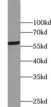 UBAP1 Rabbit Polyclonal Antibody