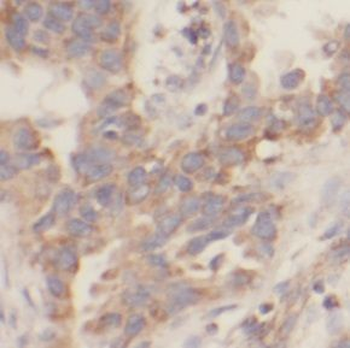 UBAP1 Rabbit Polyclonal Antibody