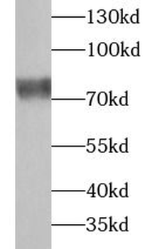 UBASH3B Rabbit Polyclonal Antibody
