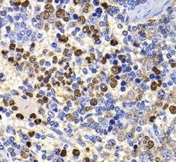 UBASH3B Rabbit Polyclonal Antibody