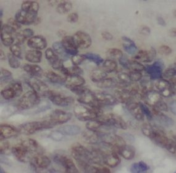 UBE2C Mouse Monoclonal Antibody