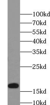 UBE2D3 Rabbit Polyclonal Antibody
