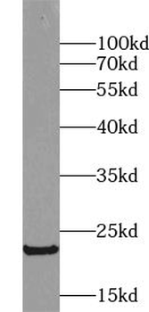 UBE2E2 Rabbit Polyclonal Antibody