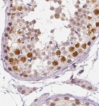 UBE2E2 Rabbit Polyclonal Antibody
