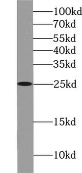 UBE2E3 Antibody
