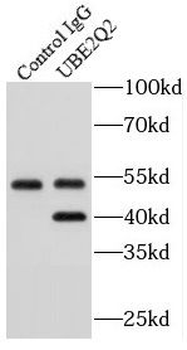 UBE2Q2 Antibody