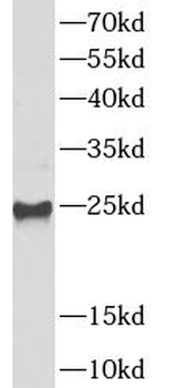 UBE2S Antibody