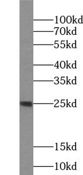 UBE2T Antibody