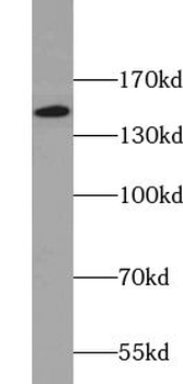 UBE4B Rabbit Polyclonal Antibody
