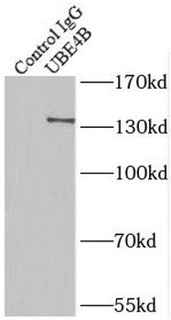 UBE4B Rabbit Polyclonal Antibody