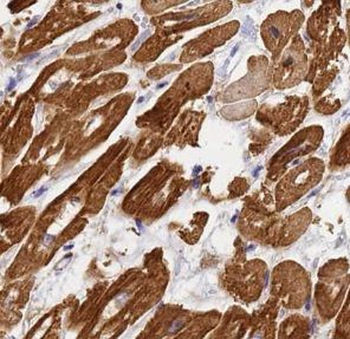 UBE4B Rabbit Polyclonal Antibody