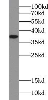UBLCP1 Rabbit Polyclonal Antibody