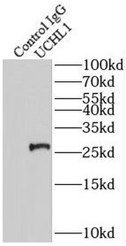 UCHL1 Antibody