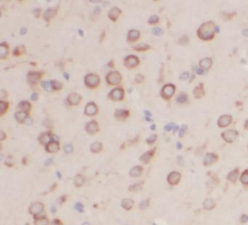 UCHL1 Antibody
