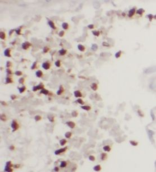 UCHL5 Rabbit Polyclonal Antibody