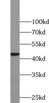 HAUS7 Rabbit Polyclonal Antibody