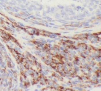 HAUS7 Rabbit Polyclonal Antibody