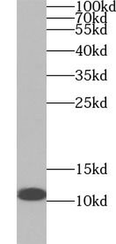 UQCR10 Rabbit Polyclonal Antibody