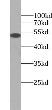 UFSP2 Rabbit Polyclonal Antibody