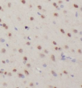 UFSP2 Rabbit Polyclonal Antibody