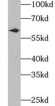 UGDH Rabbit Polyclonal Antibody