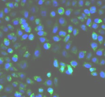 UGDH Rabbit Polyclonal Antibody
