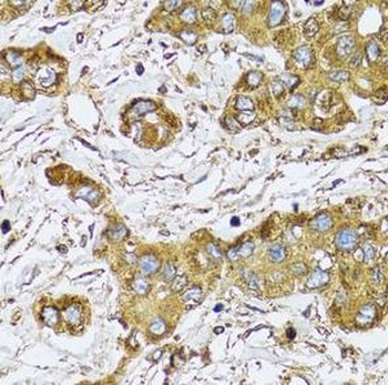 UGDH Rabbit Polyclonal Antibody