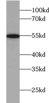 UGP2 Rabbit Polyclonal Antibody