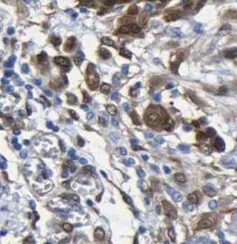 UGP2 Rabbit Polyclonal Antibody