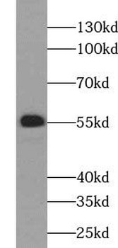 UGT2B4 Rabbit Polyclonal Antibody