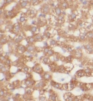 UGT2B4 Rabbit Polyclonal Antibody