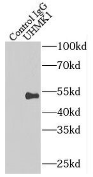 UHMK1 Rabbit Polyclonal Antibody