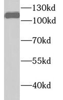 UHRF1 Rabbit Polyclonal Antibody
