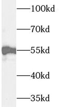 UMPS Rabbit Polyclonal Antibody